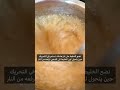طريقة الحلاوة لإزالة الشعر من الجسم