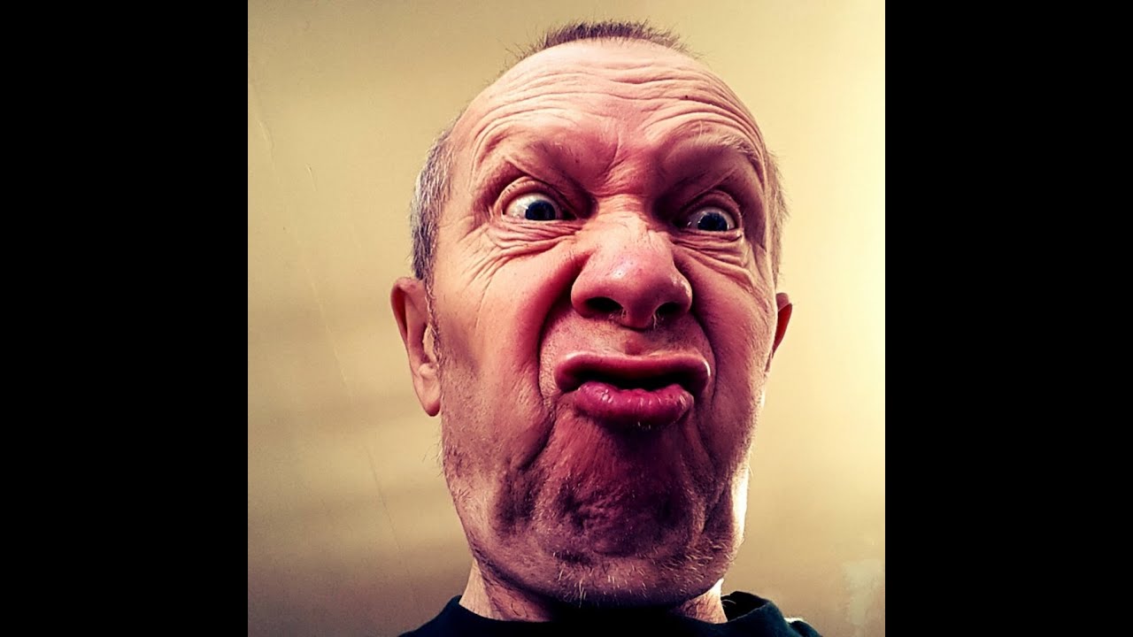 Hinoki Cypress Pruning—the good, bad, ugly & excellent