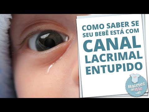 Vídeo: Bebê Bloqueado Do Canal Lacrimal: Tratamentos Em Casa