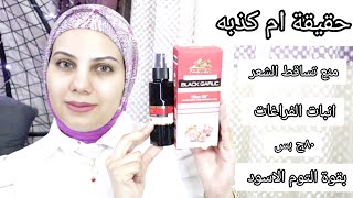 فاستر هير بالتوم لمنع التساقط وانبات الفراغات Faster hair black garlic