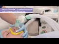 22mm Flextube™ breathing system supplied with integral monitoring line from Intersurgical