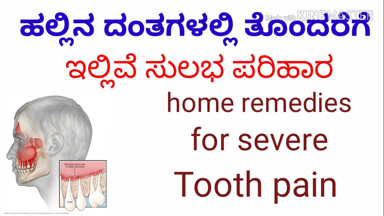 Easy home remedy for severe tooth pain in Kannada// ಹಲ್ಲುಗಳ ಸಮಸ್ಯೆಗೆ