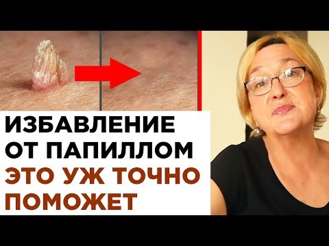 Video: Аны акыры кантип өзгөртүүгө болот?