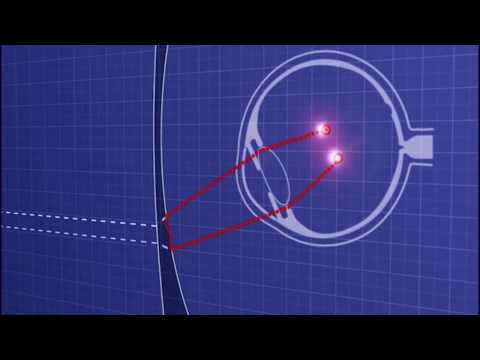 ¿Qué es un lente HD y cómo mejora la calidad óptica?