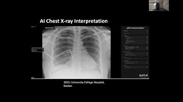 AI in Chest Imaging