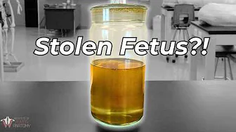 We Almost Got Robbed... Of a Fetus.