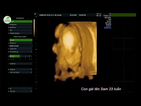 Video SIÊU ÂM HÌNH THÁI THAI NHI 4D - Con gái tên Sam 23... - youtube