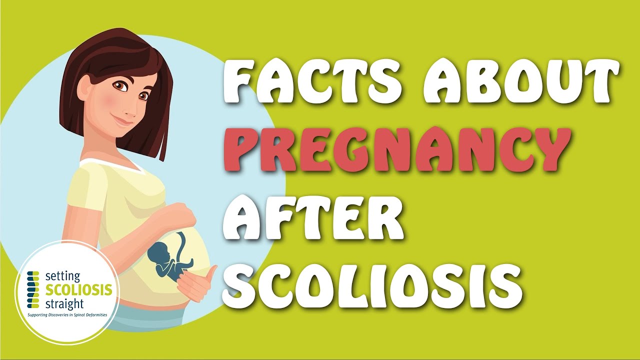 Pregnancy After Scoliosis Surgery Explained Under 1 Minute YouTube