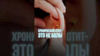 ХРОНИЧЕСКИЙ ОТИТ-ЭТО НЕ ПРО БОЛЬ! Запись к Колдовой Е.В.по номеру +78462115172