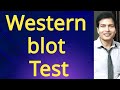 3 4 5 6 month  western blot test   