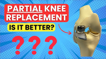 Partial Knee Replacement vs Total Knee Replacement- Which is BETTER?