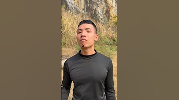 How I Cured a Bug Bite with Yogurt in theWild | Survival Hacks👃🕳️👈😆 #cartoon  #survivalskills #asmr