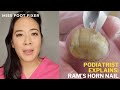 RAMS HORN TOENAILS | Trimming Extremely Long and Thick Toenails | Toenail Fungus | Miss Foot Fixer