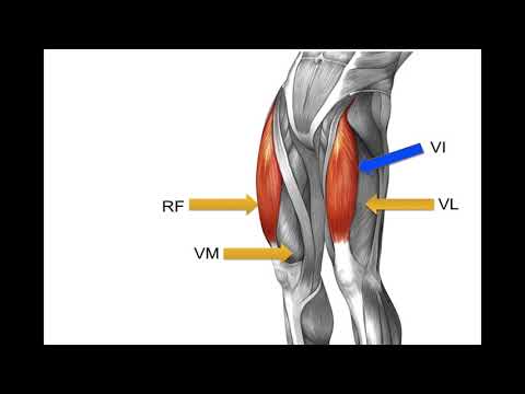 What are the quadriceps muscles?