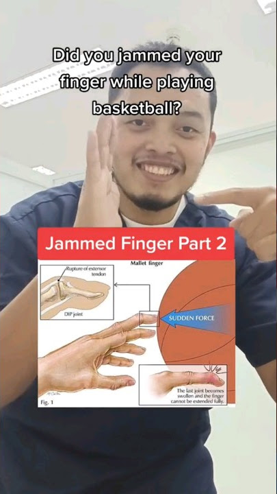 How to Unjam Your Finger in SECONDS!