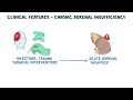 Primary adrenal insufficiency - pathology, symptoms, diagnosis, treatment