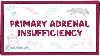 Primary adrenal insufficiency - pathology, symptoms, diagnosis, treatment screenshot 4