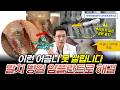 어금니 살리려 했지만 결국 뽑아야 했던 이유 | 발치 즉시 임플란트 케이스