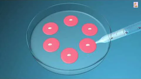 IVF: What Are Test Tube Babies? In Vitro Fertilisation Treatment Explained - DayDayNews