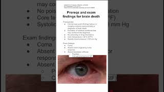 Prereqs and exam findings for brain death