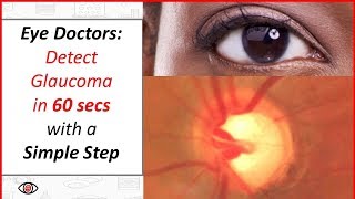 Eye Doctors: A Simple Step to Detect Glaucoma in 60 Seconds!