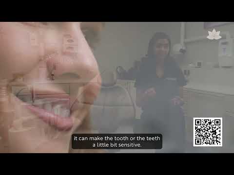 Does whitening damage your teeth?, Lotus Clinic Golders Green