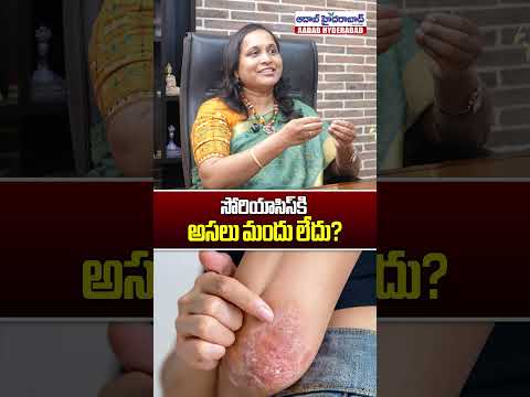 సోరియాసిస్ కి అసలు మందు లేదా? | Is There a Cure for Psoriasis? | Dr. Jyotsna Gampa | Aadab Hyderabad