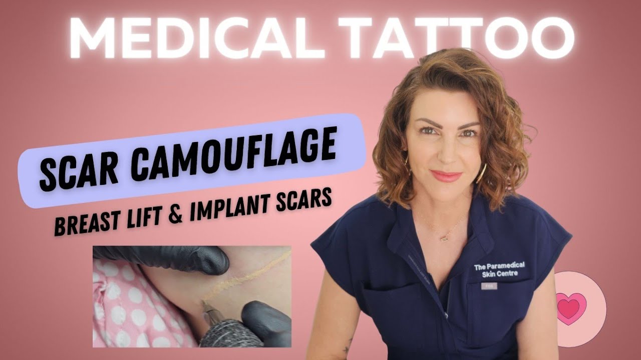 How We Blend Breast Lift Scars with Camouflage Tattooing