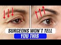 Girls regret not doing THESE EXERCISES earlier! / How to lift drooping eyelids WITHOUT SURGERY?