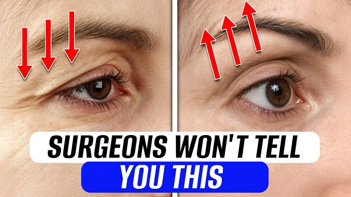 Girls regret not doing THESE EXERCISES earlier! / How to lift drooping eyelids WITHOUT SURGERY?