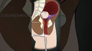 What happens during an abbortion?(3D animation) #slipdiscsurgery #3danimation #science #humanhand