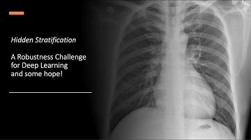 Hidden Stratification: A Robustness Challenge for Deep Learning
