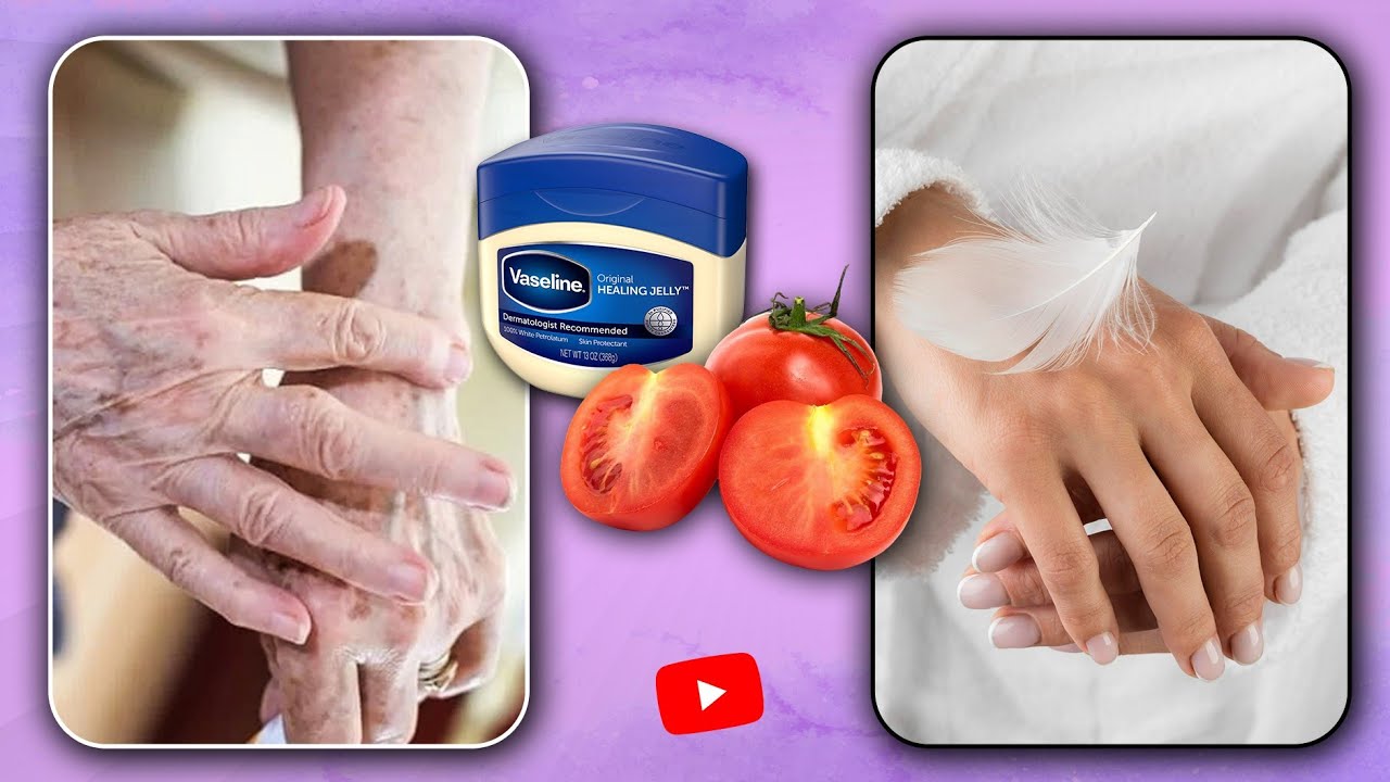 این ماسک ضدپیری و لایه بردار را درست کنید و یک شبه پوست خود را روشن و جوان کنید! 💯