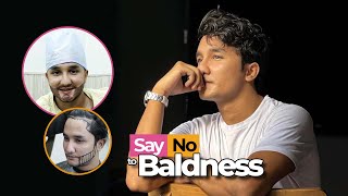 SAY NO TO BALDNESS - ZUHAB KHAN - HAIR & BEARD TRANSPLANT