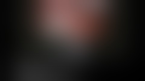 BK Medical  Robotic assisted Partial Nephrectomy with 3D Rendering by Michael Stifelman, MD