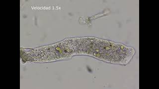 La Increíble Ameba que Cambia de Forma para Sobrevivir: Amoeba Proteus