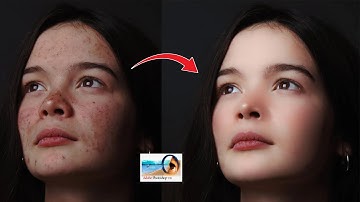 1 Click Skin Retouching & Pimple Remove in Photoshop 7.0