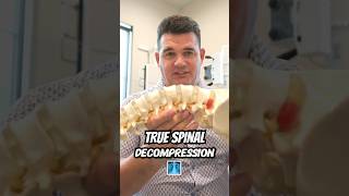 TRACTION VS. DECOMPRESSION (There's a difference)