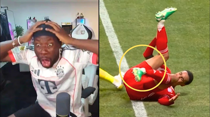 Alphonso Davies' Reaction to Jamal Musiala Horrible Leg Injury vs PSG 😳 | Bayern Munich