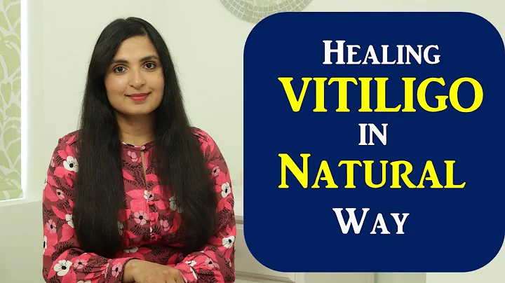 Healing Vitiligo Naturally | What Causes White Spots| How to Clear White Spots on the Skin Naturally - DayDayNews