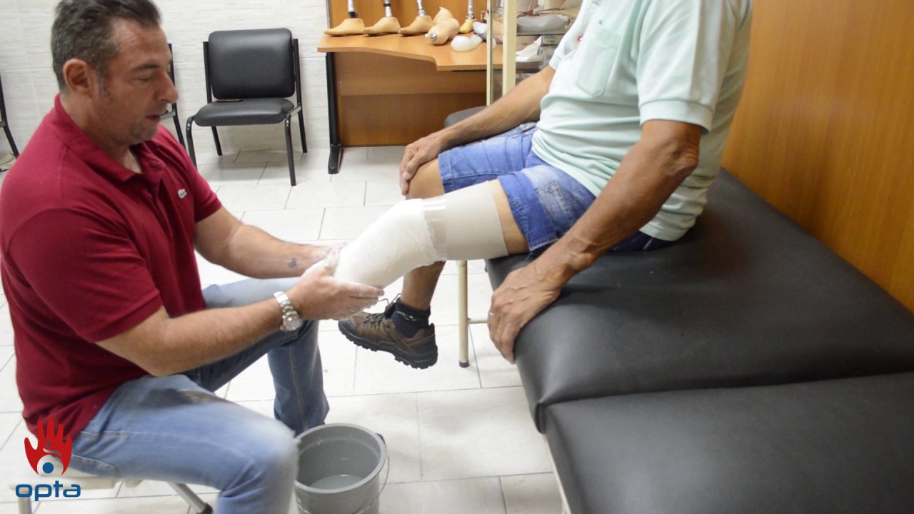 Sistema de liner de 5 anéis nas amputações transtibiais (confecção de A a Z)