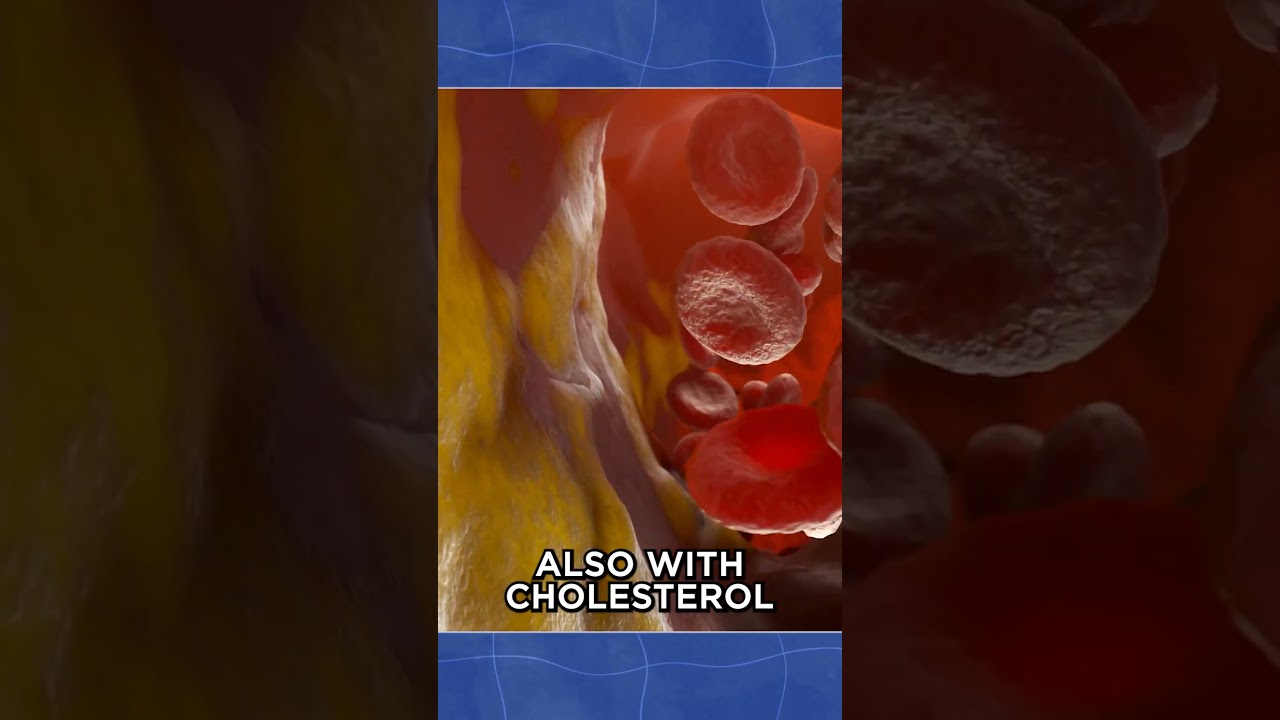 BMI’s Significance In Gulf War Illness