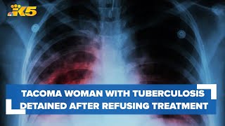 Tacoma woman with tuberculosis detained after refusing treatment