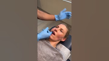 TMJ DISORDER: SATISFYING TREATMENT😪