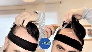 Learn How To Remove Hair System | Before/After Non-Surgical Hair Replacement System Men/Women UK/USA