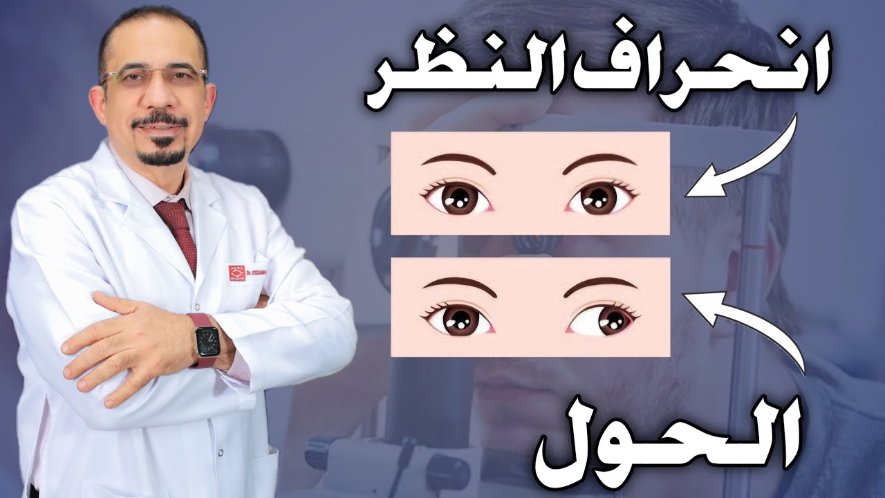 الفرق بين الحول وانحراف النظر | الجزء الأول من علاج الحول