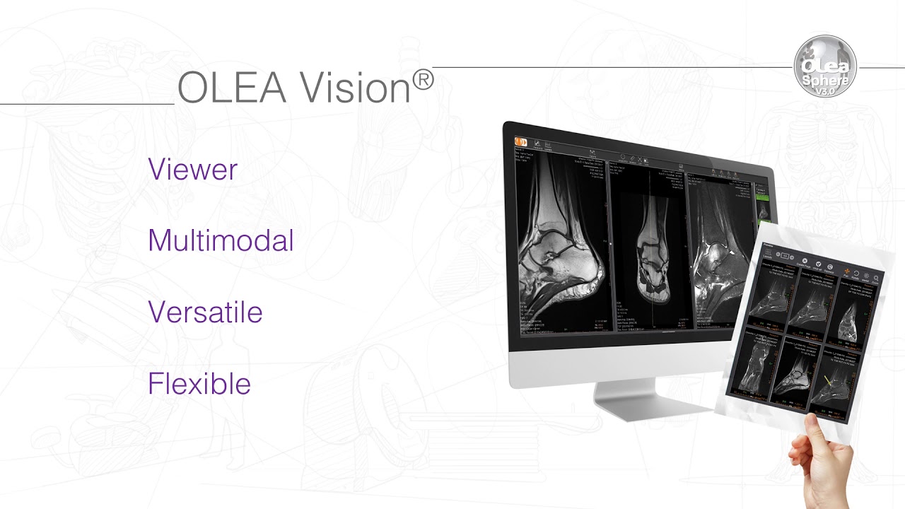 Olea Sphere v3.0 - Olea Vision new generation viewer