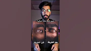 افضل طريقه لتصوير العين بالموبايل بكل وضوح معاذ ستار 