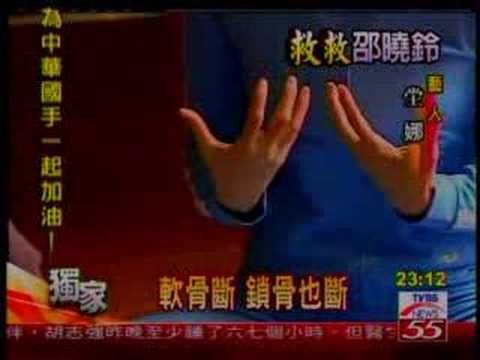 堂娜談11年前大車禍之復健路