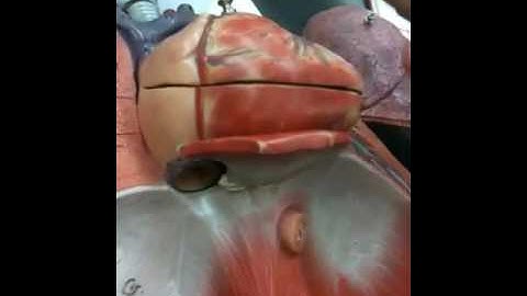 Thoracic model part II test # 3